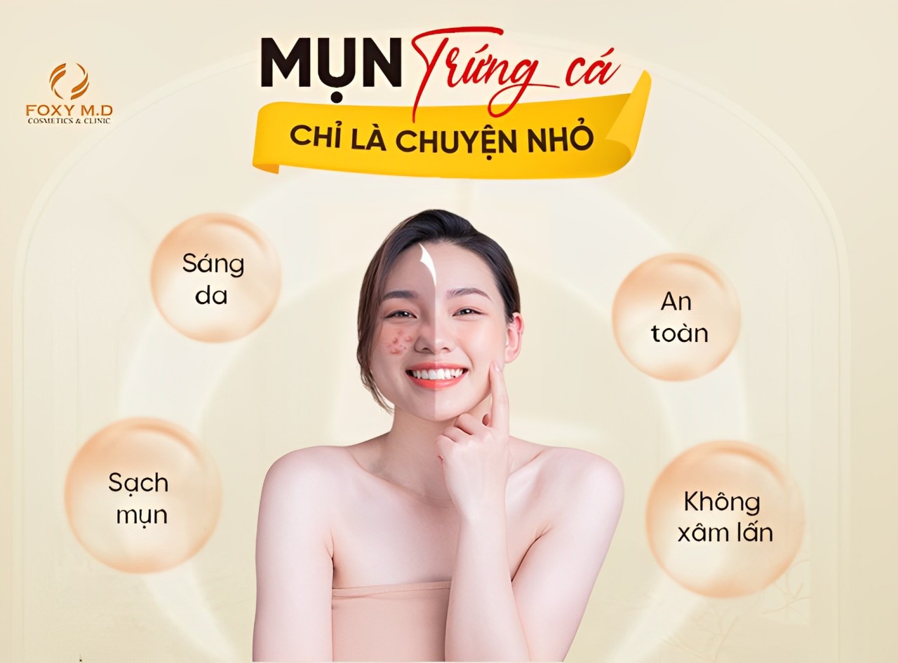 Khám phá Thẩm mỹ viện trị mụn tốt nhất Đà Nẵng với quy trình chuyên sâu cho làn da hoàn hảo